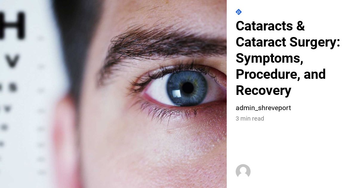 Cataract Surgery The Complete Guide to Cataract Surgery in 2022