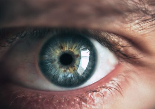 Age-Related-Macular-Degeneration