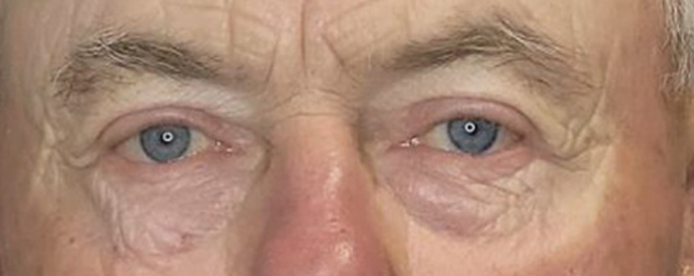 SES-ZipLyft-after-2